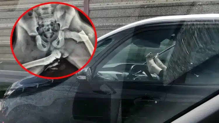 koju laikymas ant prietaisu skydelio automobilyje