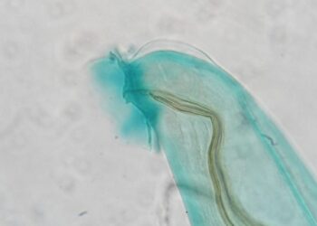 Angiostrongylus cantonensis ziurkiu plauciu kirminas