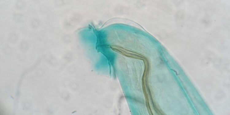 Angiostrongylus cantonensis ziurkiu plauciu kirminas
