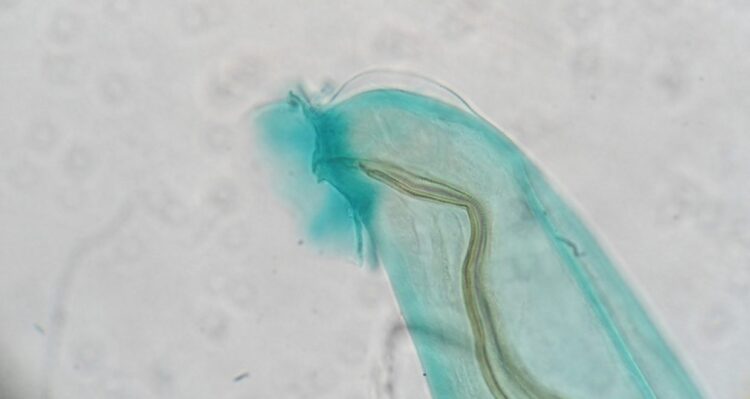 Angiostrongylus cantonensis ziurkiu plauciu kirminas